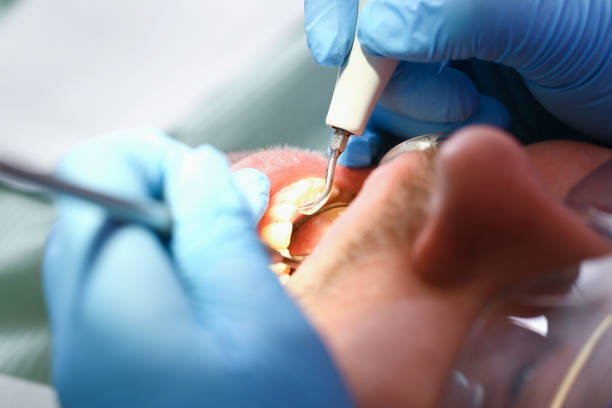 Best Emergency Dental Care for Abscessed Tooth in Soperton, GA